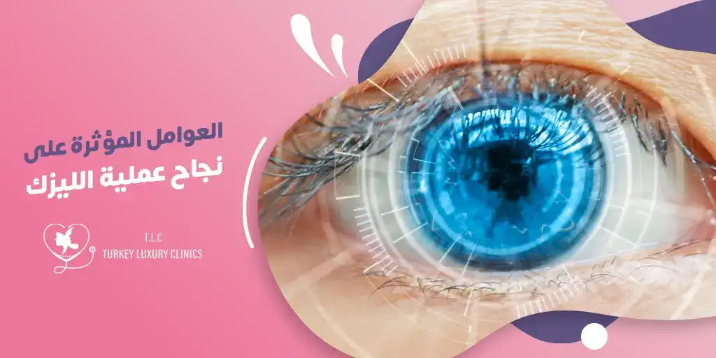ماهي عوامل نجاح عملية الليزك؟