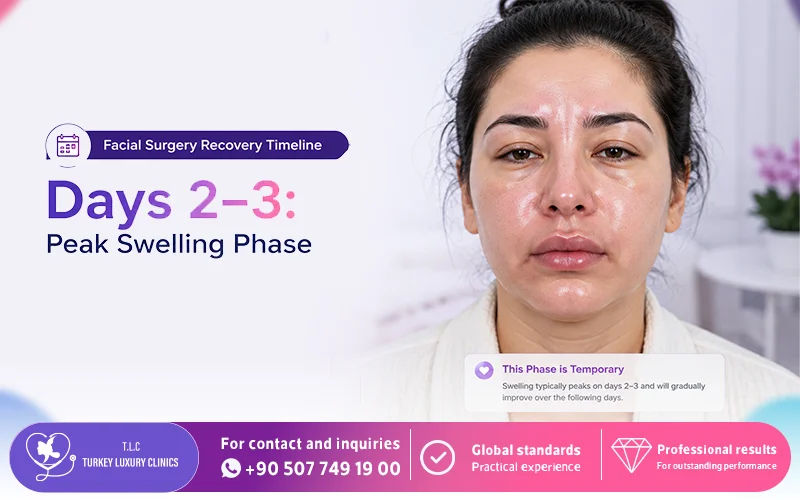 Days 2–3: Peak Swelling Phase