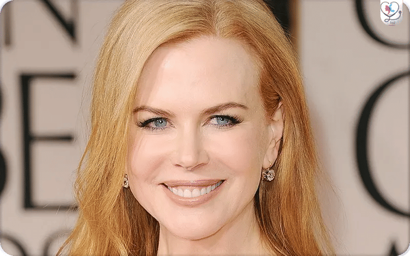 Nicole Kidman Plastic Surgery Rumors Over the Years 2