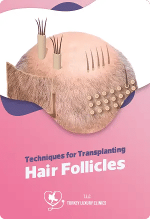 Techniques For Transplanting Hair Folliclesfeatured image