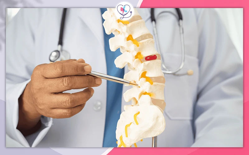 What Is Stem Cell Therapy for a Herniated Disc?