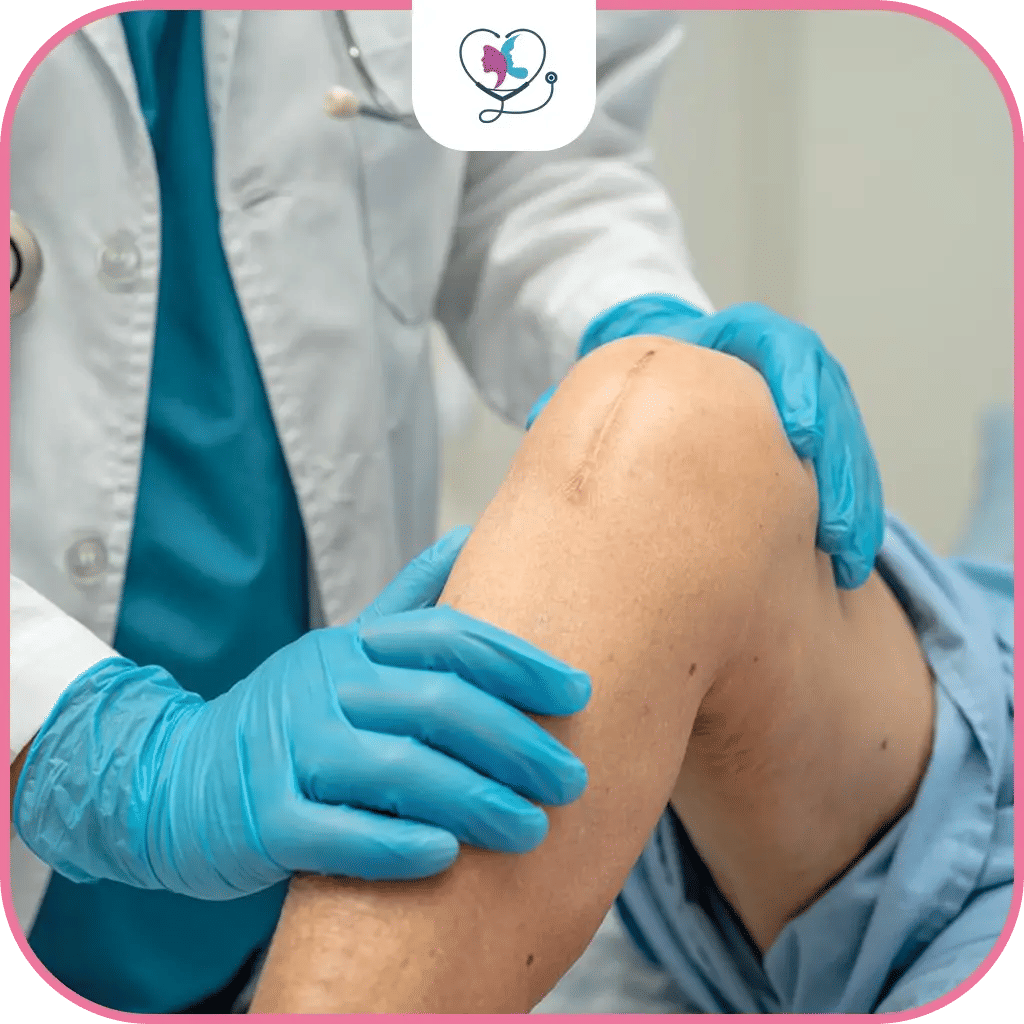 11. الكسر الدقيق Microfracture