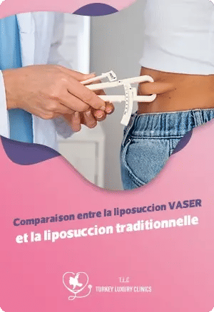 Liposuccion Vaser vs traditionnelle : Quelle option choisir?