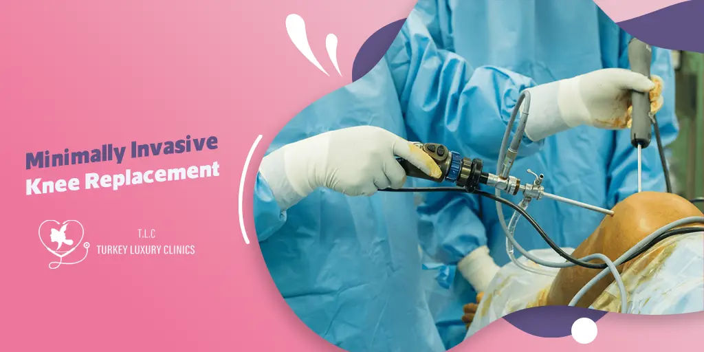 Minimally Invasive Knee Replacement