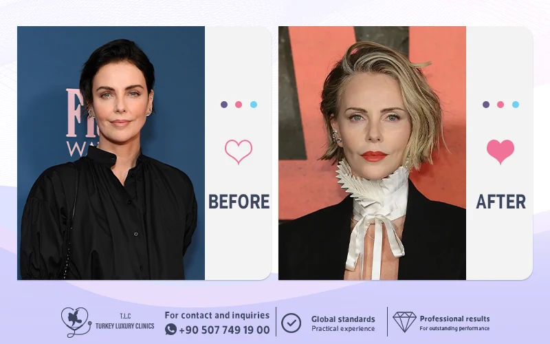 Charlize Theron Antes y Después: Comparación 2022 vs 2026