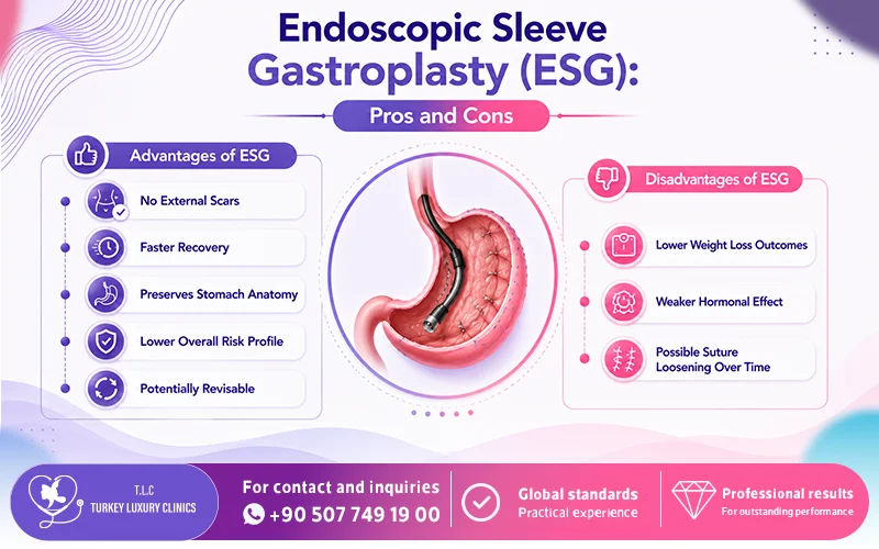Endoscopic Sleeve Gastroplasty (ESG): Pros and Cons