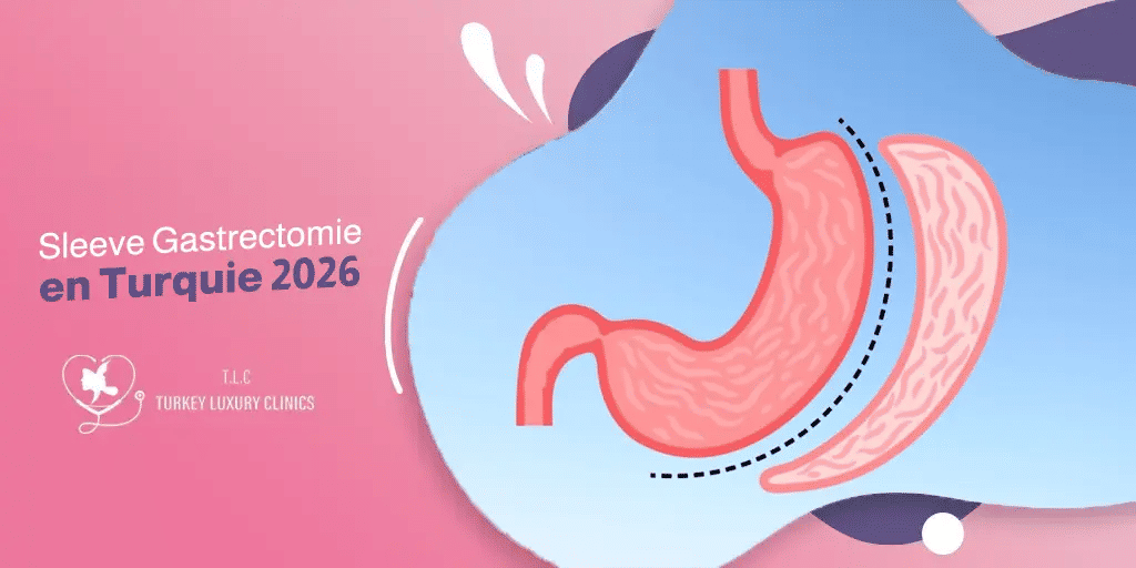 Sleeve Gastrectomie en Turquie 2026 : Prix et Avantages