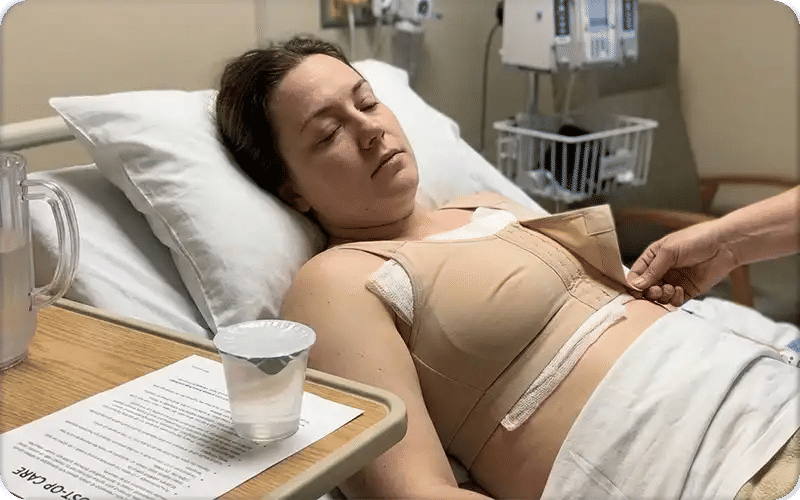 Breast Reduction Recovery