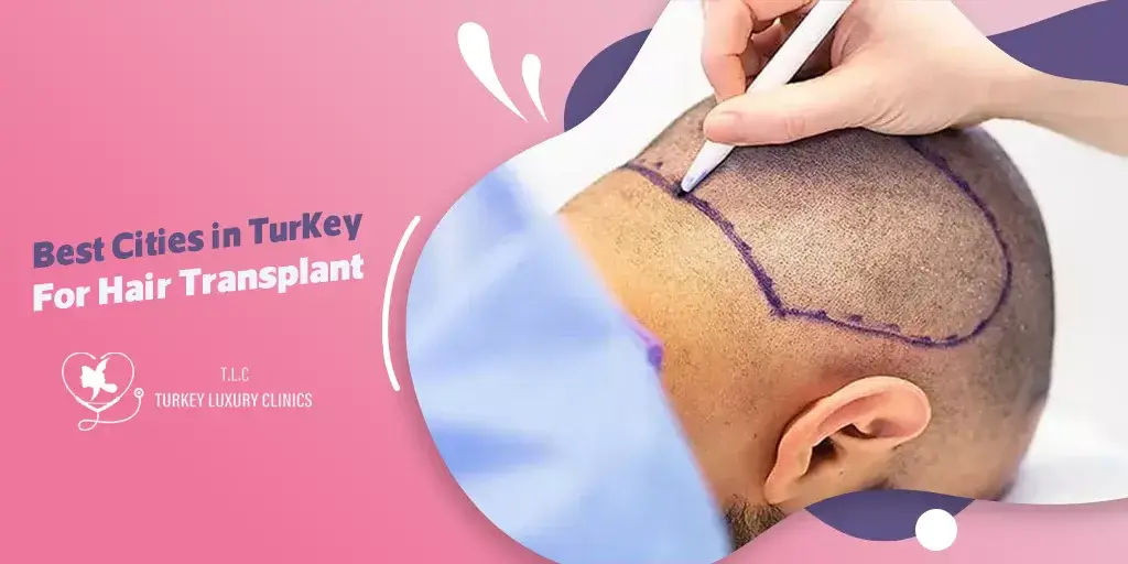 Migliore Clinica Trapianto Capelli Turchia: Turkey Luxury Clinics
