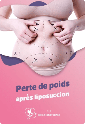 Perte de poids après liposuccion : Ce qu'il faut savoirfeatured image