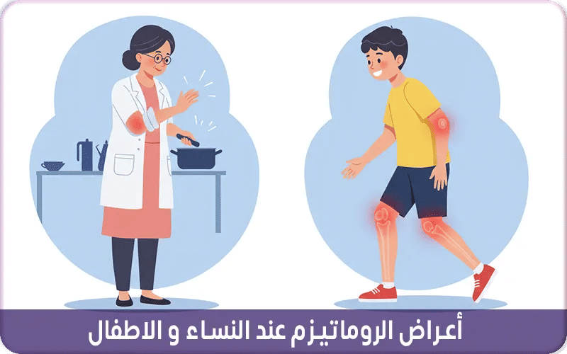 أعراض الروماتيزم عند النساء