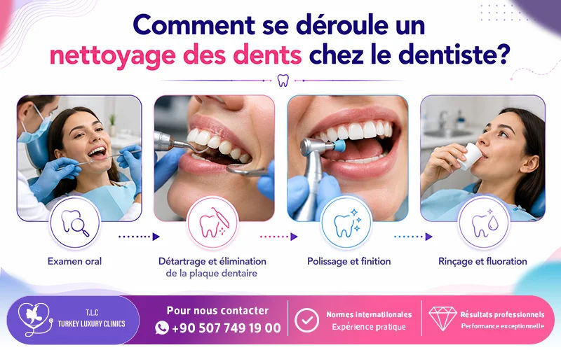 Comment se déroule un nettoyage des dents chez le dentiste? 