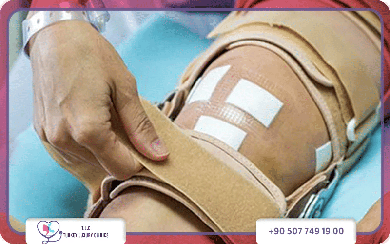 هل تعود الركبة كما كانت بعد عملية الرباط الصليبي؟