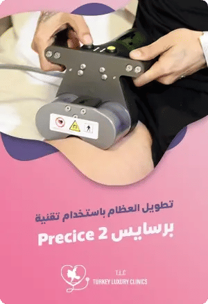 تطويل العظام باستخدام تقنية برسايس Percise 2featured image