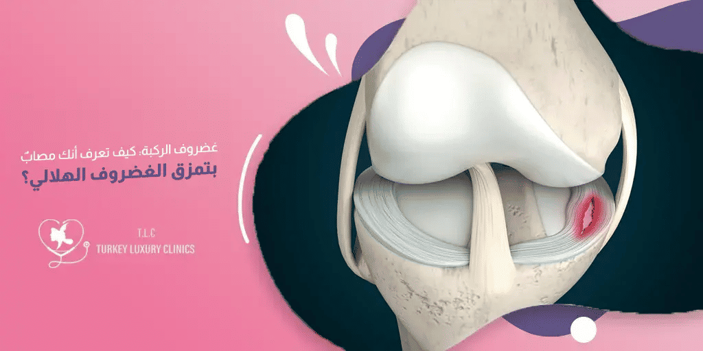 غضروف الركبة: الإصابات والأعراض والعلاج في تركيا