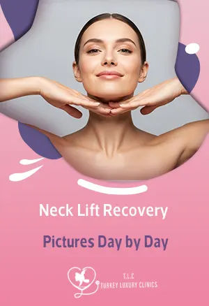 Neck Lift Recovery Pictures Day by Day (Day 1 to Month 12)