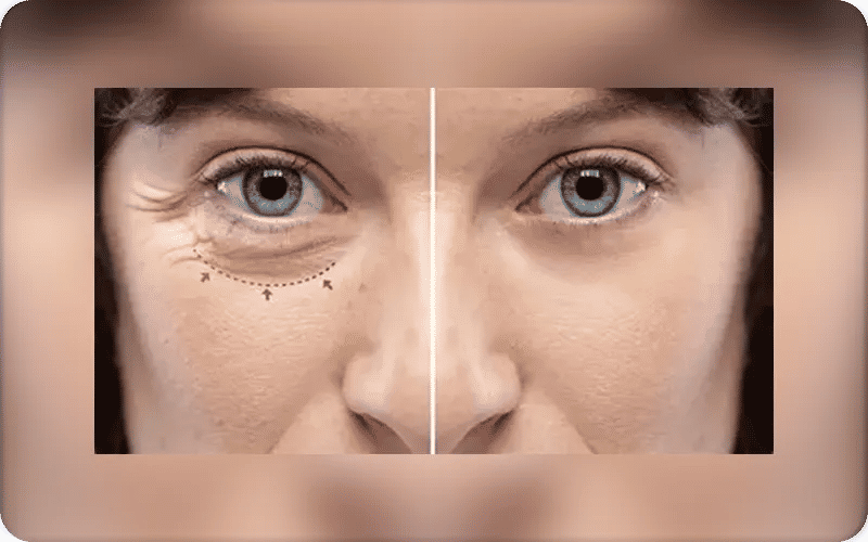 العودة إلى الغرفة