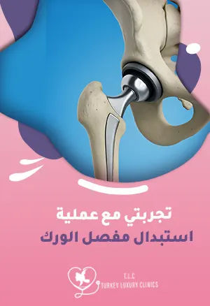 تجربتي مع عملية استبدال مفصل الوركfeatured image
