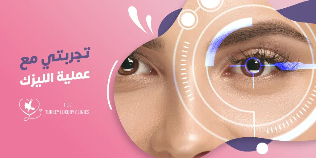 تجربتي مع عملية الليزك