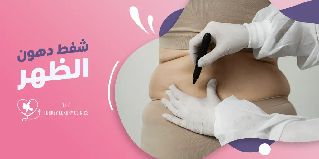 شفط دهون الظهر