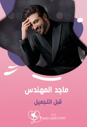 ماجد المهندس قبل التجميل: عمليات الأنف والوجه وزراعة الشعر