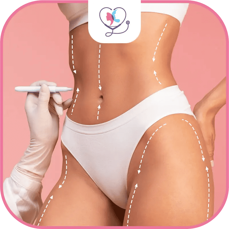 الفرق بين شفط الدهون ونحت الجسم