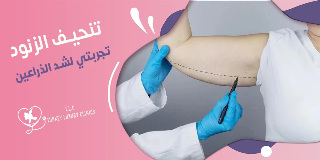 تنحيف الزنود تجربتي لشد الذراعين ونتائج صور قبل وبعد