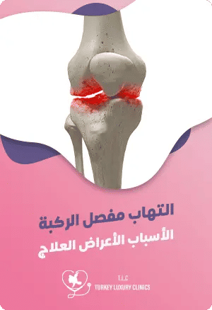 التهاب مفصل الركبة: الأسباب، والأعراض والعلاجfeatured image