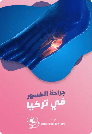 جراحة الكسور الرياضية في تركياfeatured image