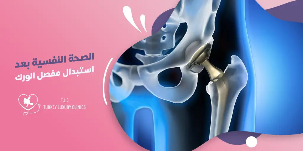 الصحة النفسية بعد جراحة استبدال مفصل الورك