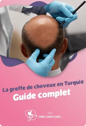 Greffe de cheveux en Turquie: Le guide complet