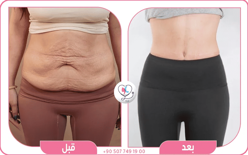 الوصول إلى تركيا والتجهيز للعملية