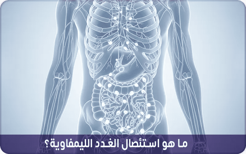 ما هو استئصال الغدد الليمفاوية؟