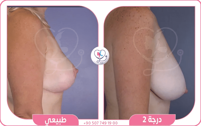 الدرجة الثانية أو المتوسطة