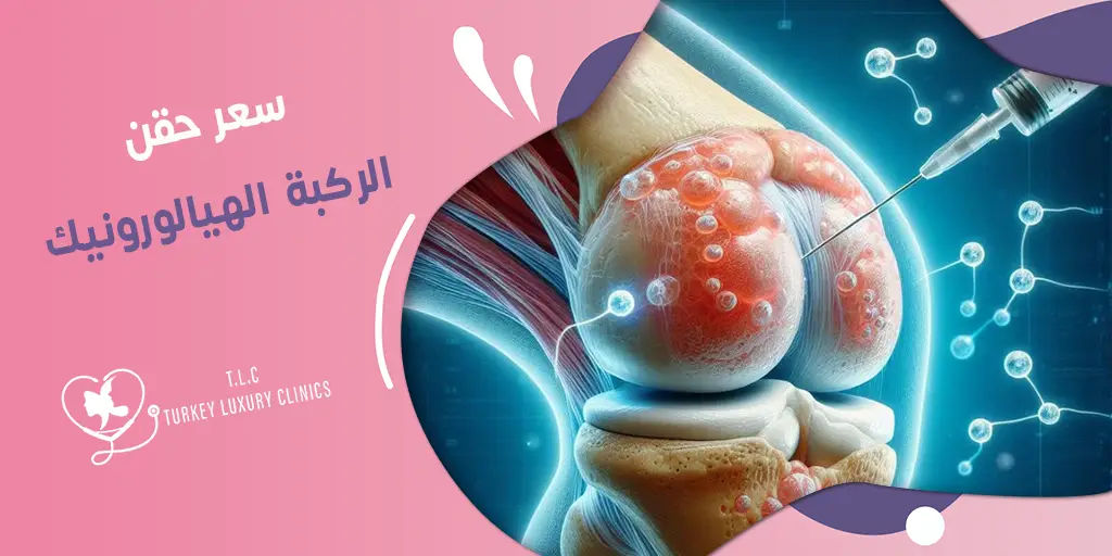 سعر حقن الركبة الهيالورونيك: تركيا والسعودية وباقي الدول