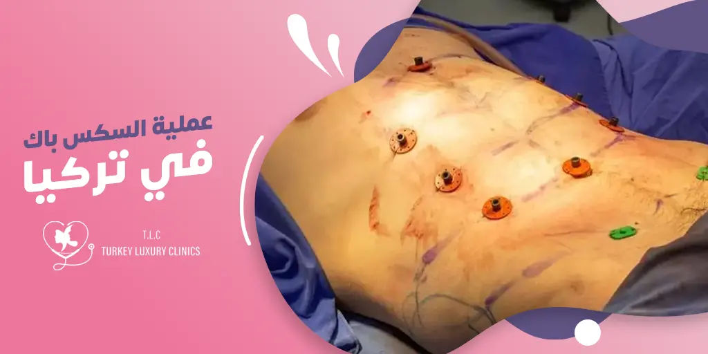 عملية Six-Pack في تركيا: دليلك الشامل