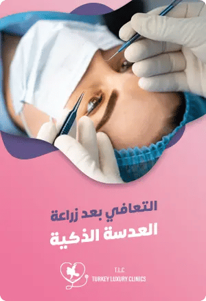 التعافي بعد زراعة العدسة الذكية: الحياة بعد العمليةfeatured image