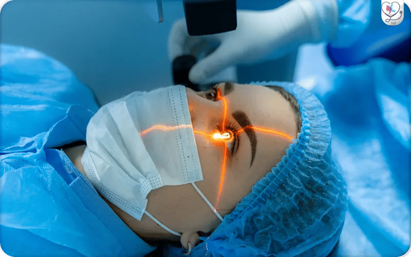 Chirurgie réfractive c’est quoi ?