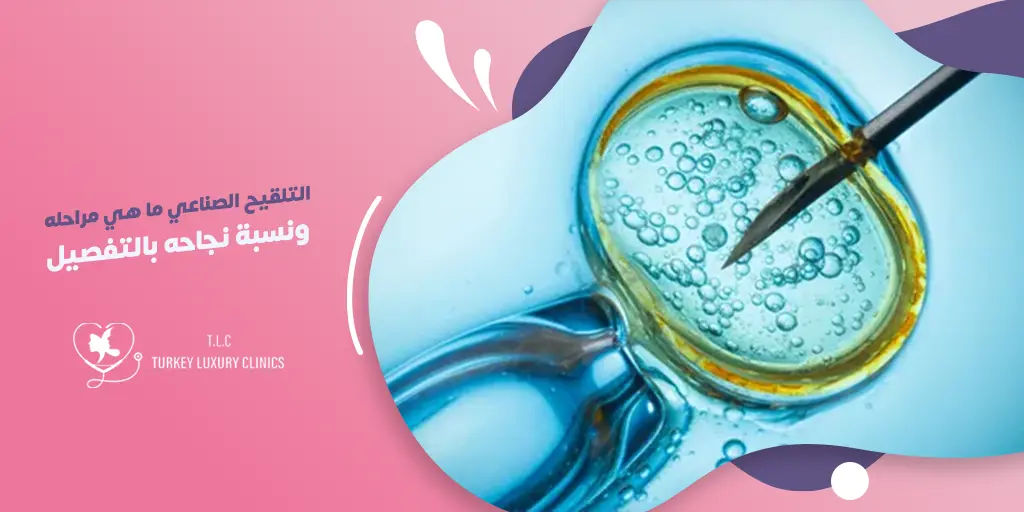 التلقيح الصناعي: ما هي مراحله ونسبة نجاحه بالتفصيل؟