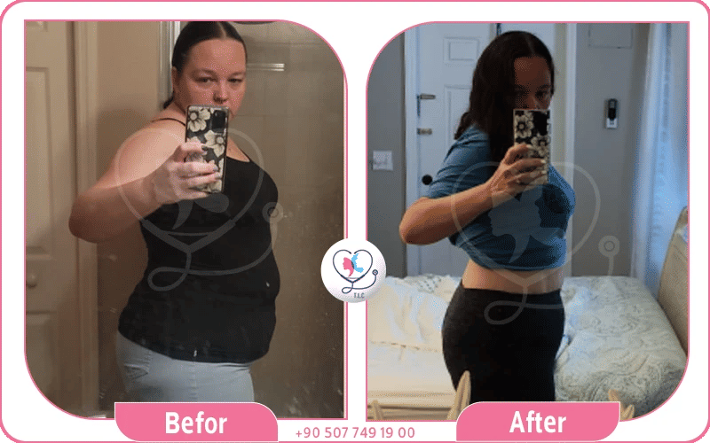 هل ابر المنجارو تمنع الحمل؟