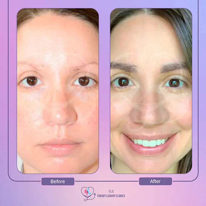 galerie-de-nos-résultats-en-gros-plan