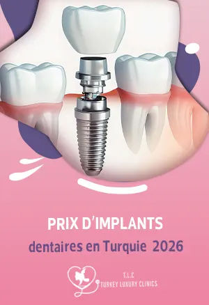 Prix d'Implants dentaires en Turquie  2026 