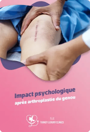 Impact psychologique après arthroplastie du genoufeatured image