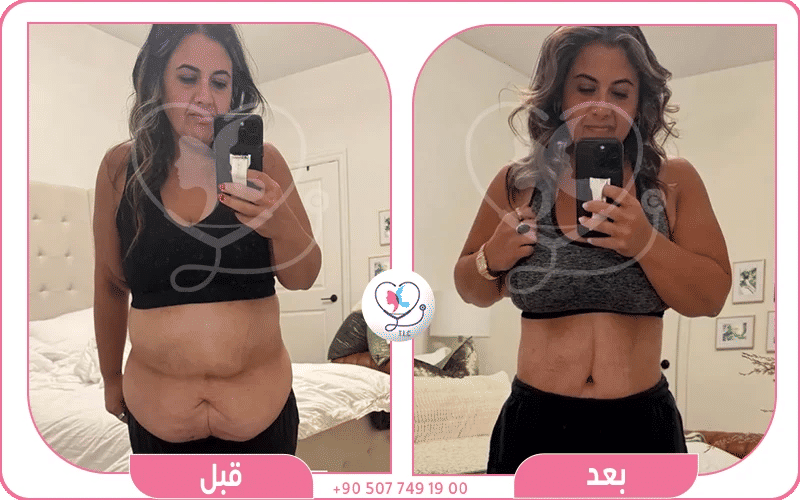 خدماتٌ متكاملة وفترة نقاهة
