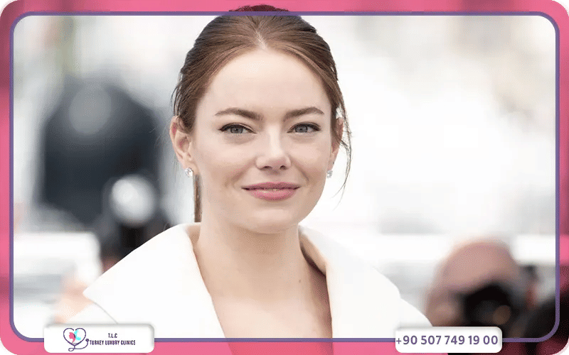 Emma Stone Plastic Surgery Controversy