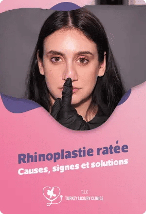 Rhinoplastie ratée : Causes, signes et solutions
