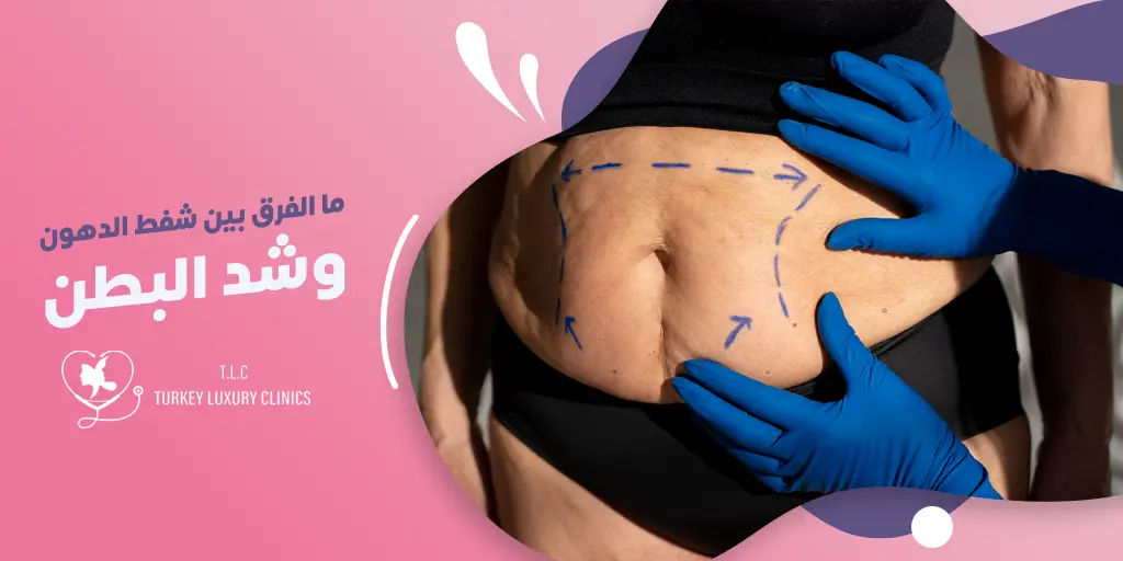 ما الفرق بين شفط الدهون وشد البطن؟