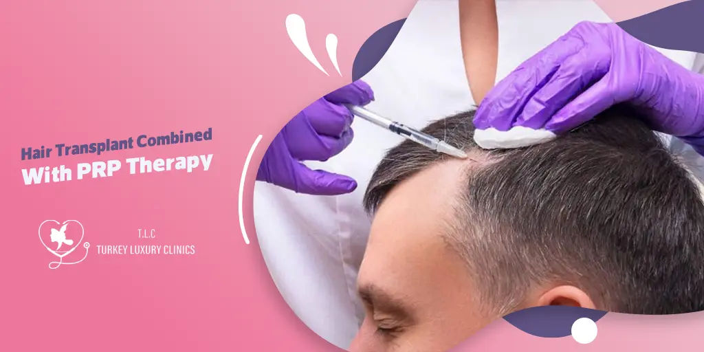 Hair Transplant Combined With PRP Therapy