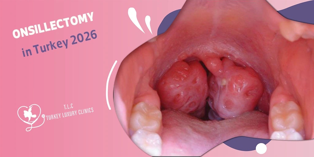 Tonsillectomy in Turkey 2026: Surgery, Recovery, Costs & Adult vs Kids