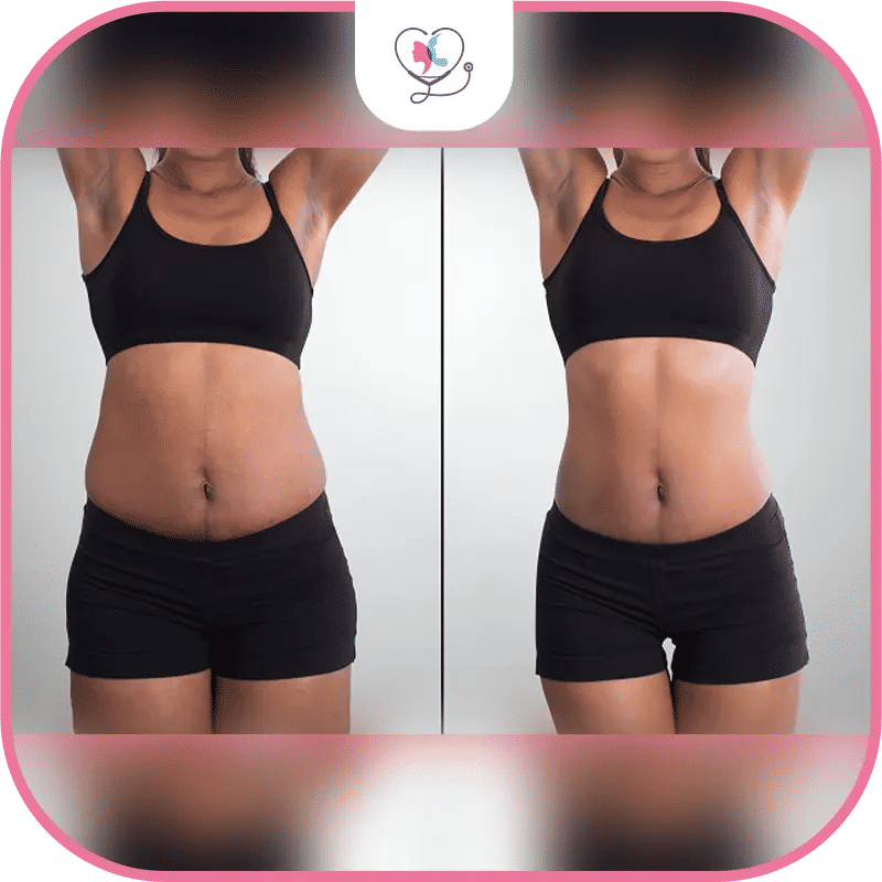 جهاز الكافيتيشن: كل ما تريد معرفته